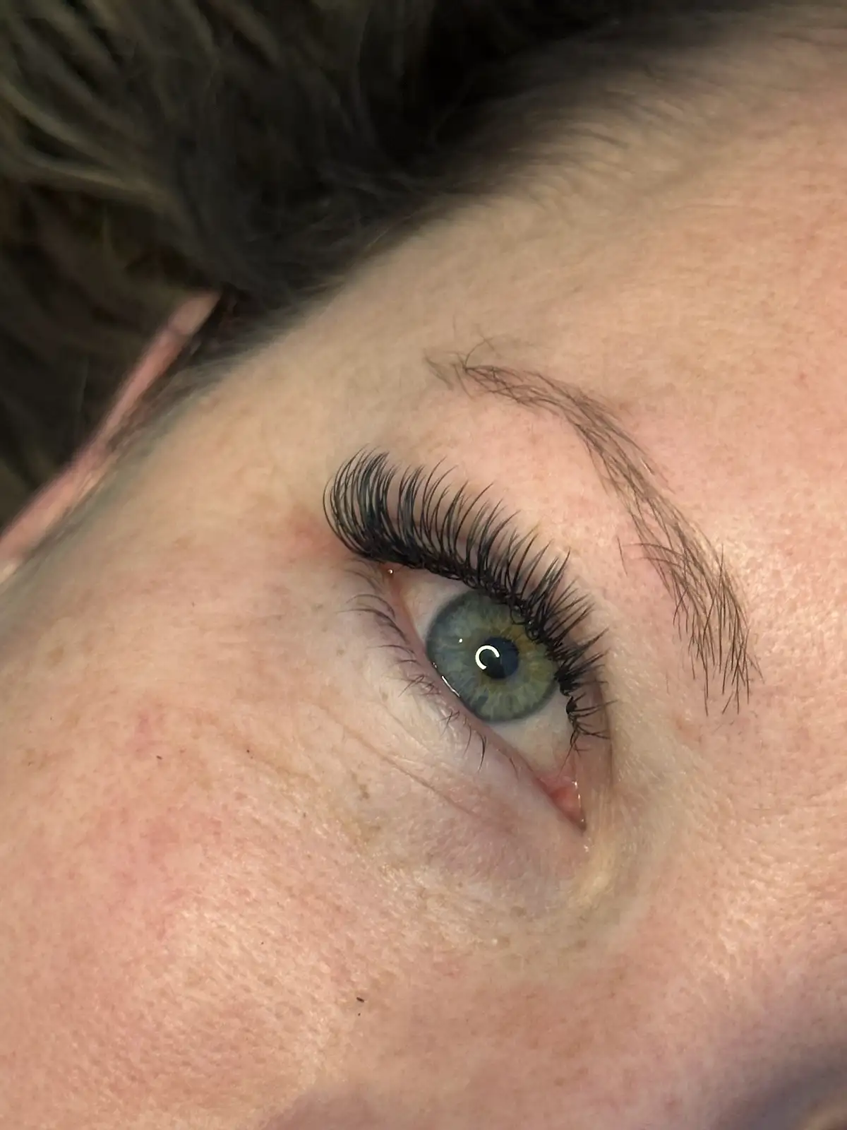 After — Classic Set